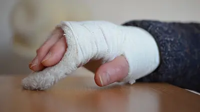 Krzywa ręka po gipsie: prosty powrót do zdrowia